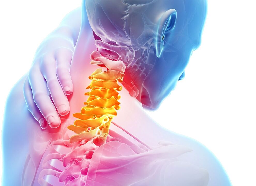 příznaky cervikální osteochondrózy